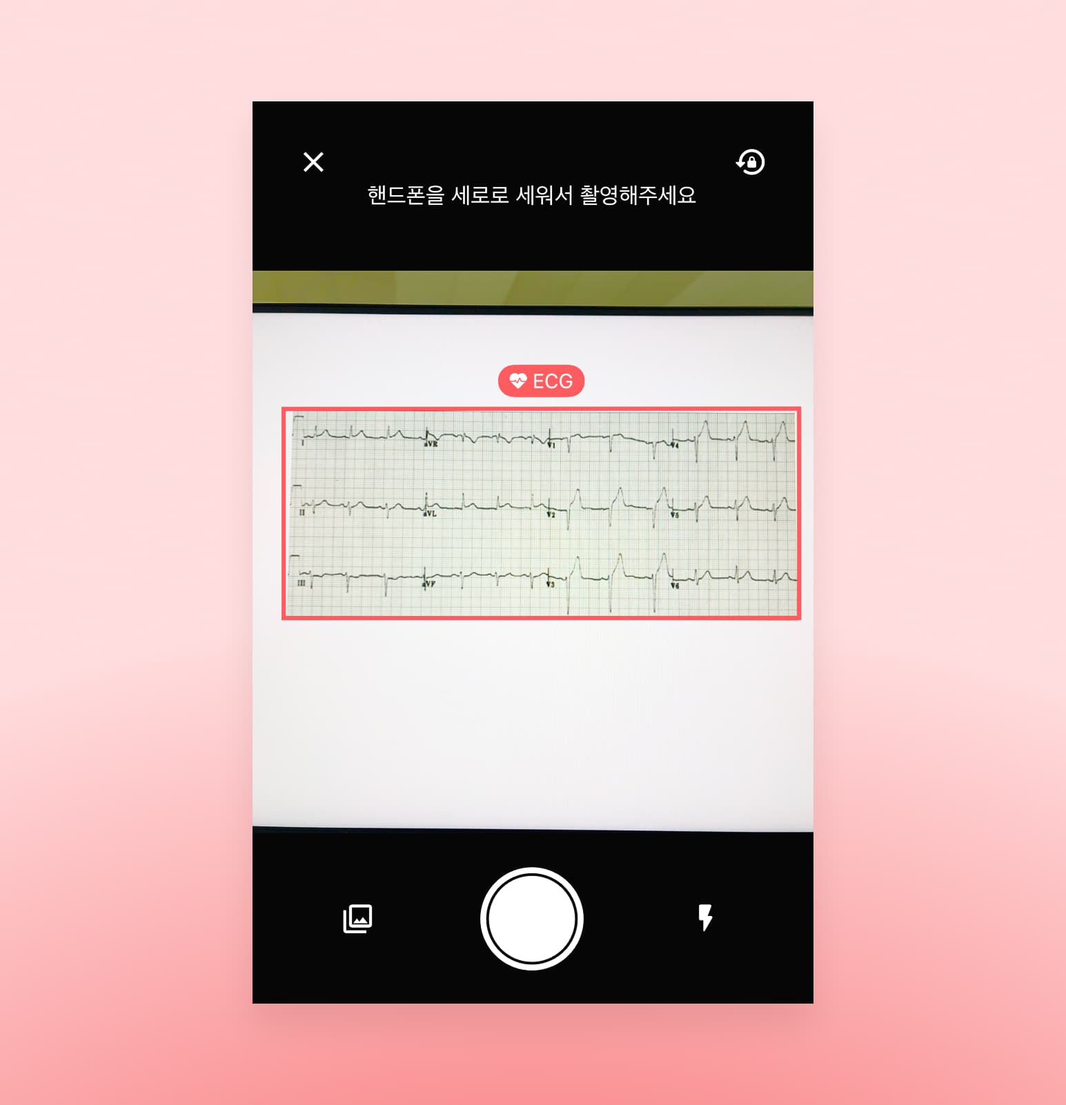 심전도 영역 자동 인식