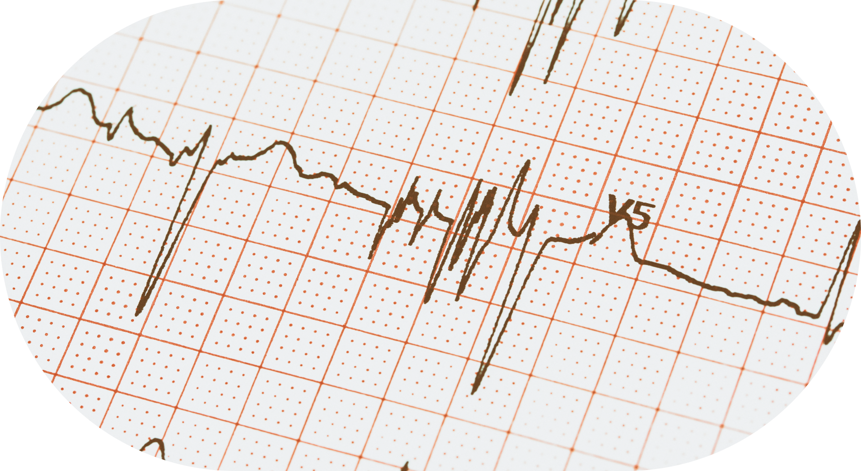 biomarker