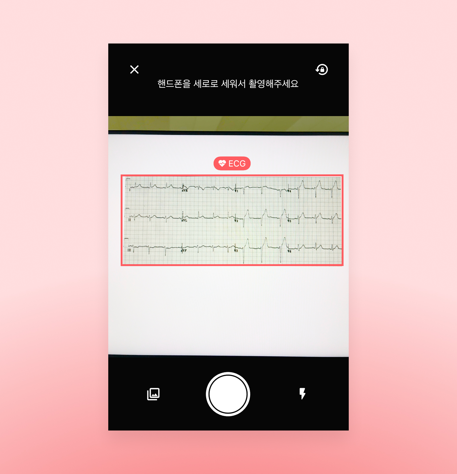 심전도 영역 자동 인식